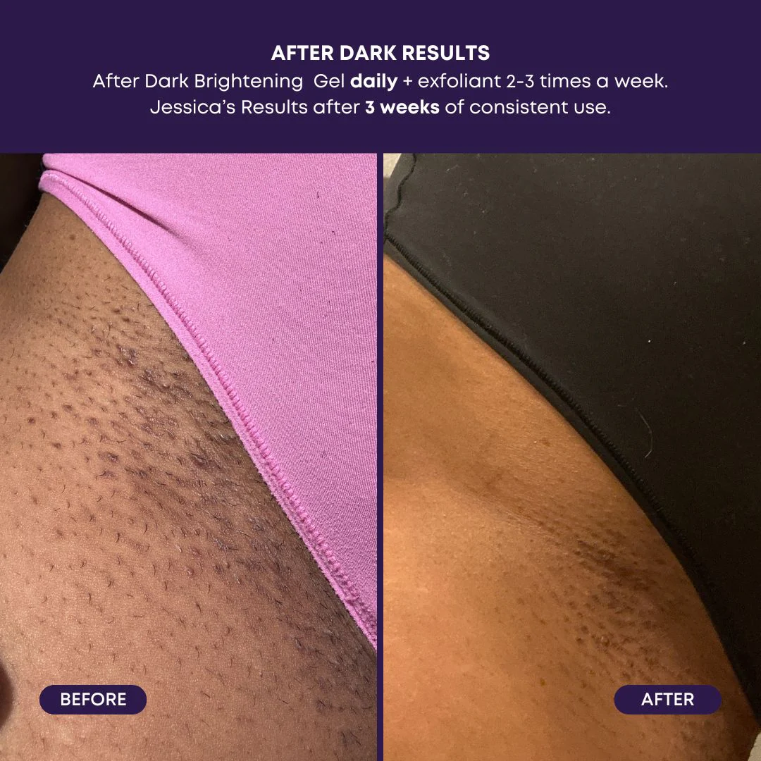 After Dark Brightening Gel - Image 4