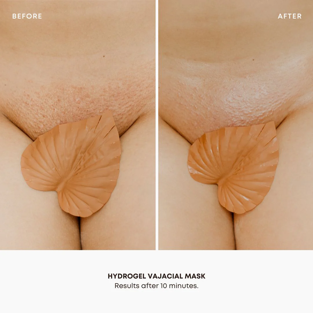 Hydrogel Vajacial Mask - Image 5