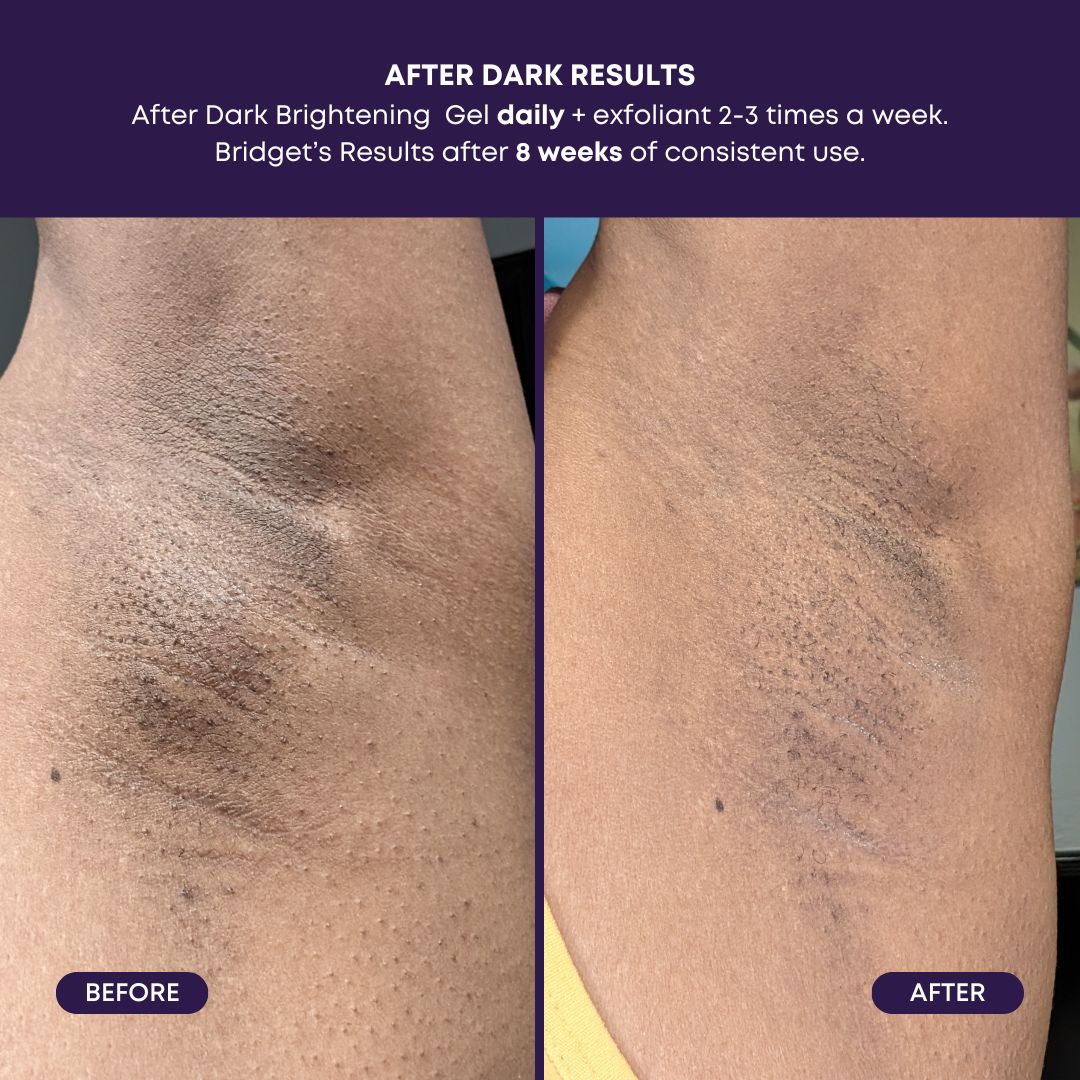 After Dark Brightening Gel - Image 3